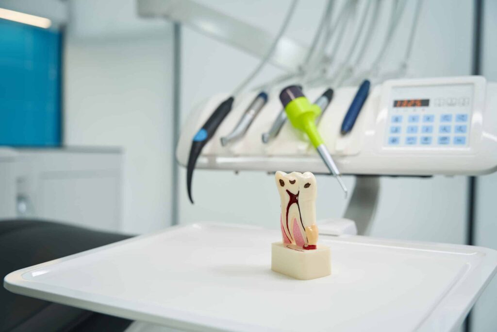 Ashbourne Dental & Medical – Root Canals