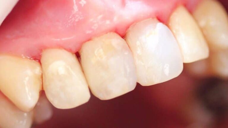 Ashbourne Dental & Medical – after 2 800×450 1.jpg