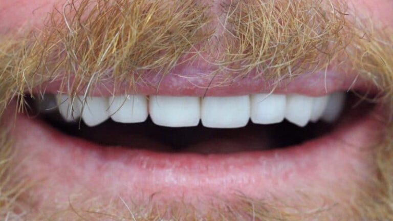 Ashbourne Dental & Medical – after 4 800×450 1.jpg