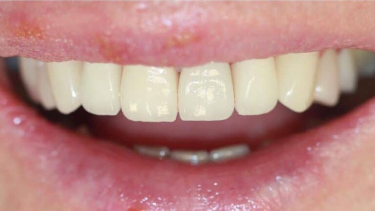 Ashbourne Dental & Medical – after 800×450 1.jpg