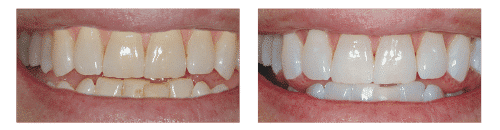 Ashbourne Dental & Medical – teeth